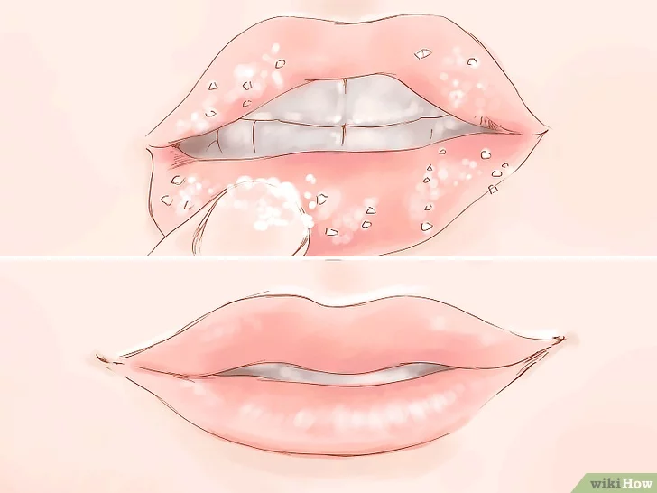 v4 728px kiss step 6 version 5.jpg